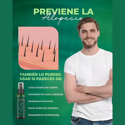 OUHOE- CRECIMIENTO Y CONTROL DE CAIDA DE CABELLO