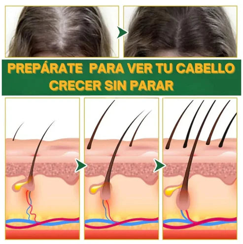 OUHOE- CRECIMIENTO Y CONTROL DE CAIDA DE CABELLO